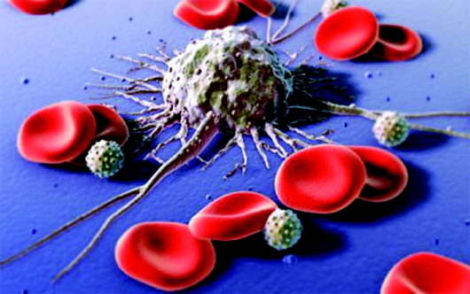 赵永强:血友病患者就诊率不足一半