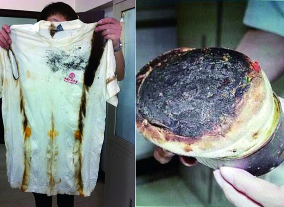 黑心煎饼摊用袜<em>内裤</em>当油擦城管队员:看着就想